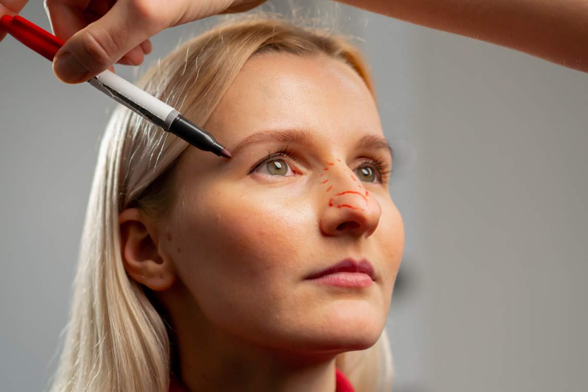 in a plastic surgery clinic doctor makes markings on the face of a young girl before surgery